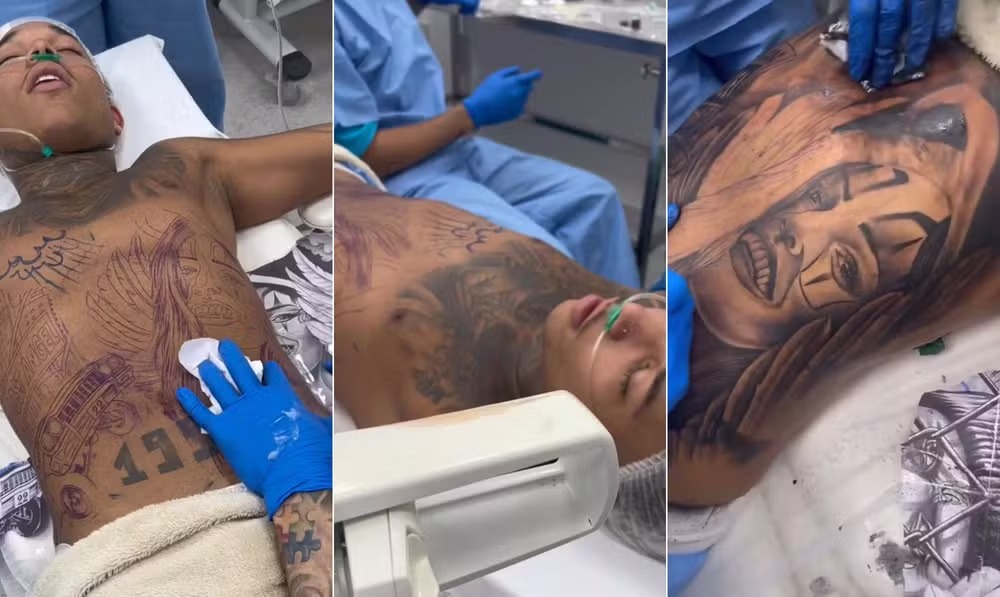 DJ é sedado para realizar tatuagem. 