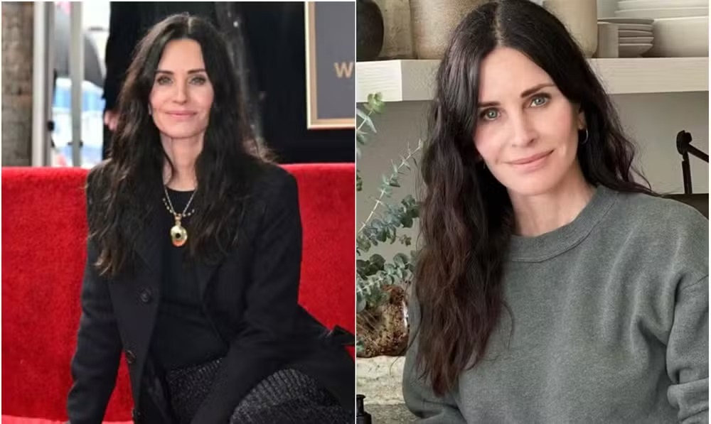 Courteney Cox antes e depois de desfazer uma harmonização facial 