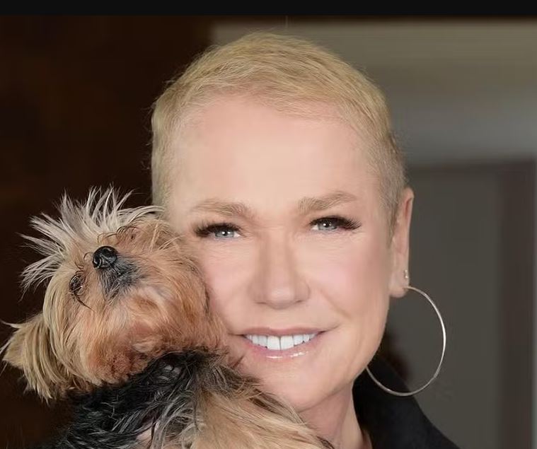 Xuxa passa por transplante capilar 