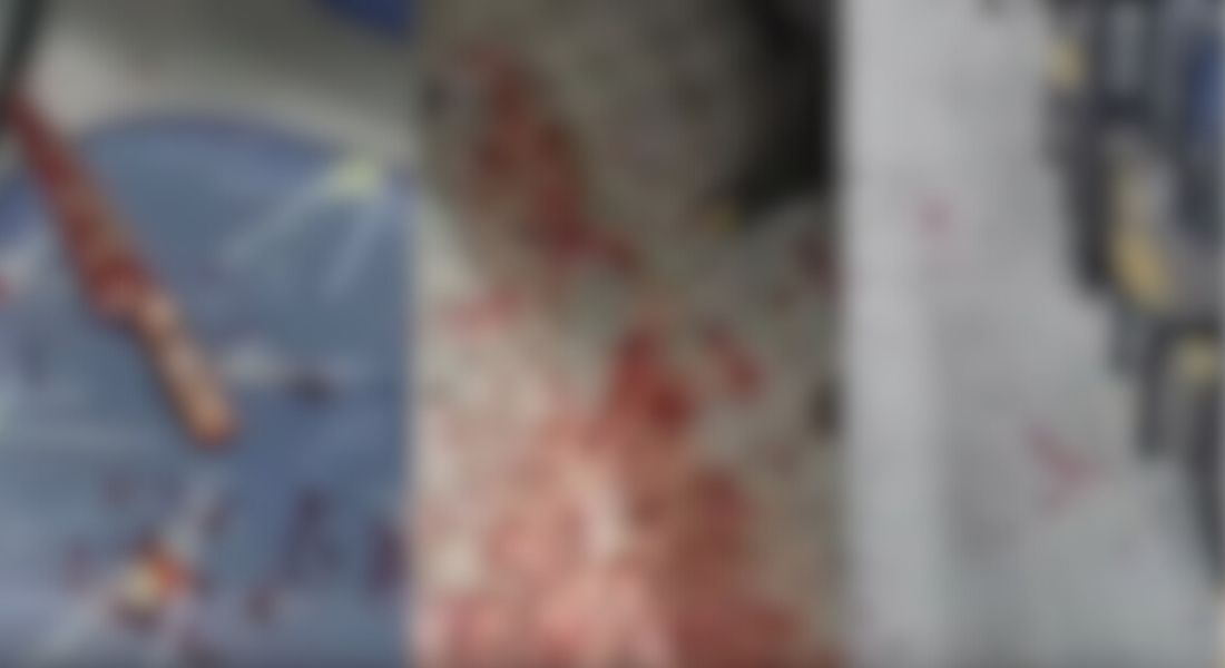 O homem teria reagido ao assalto